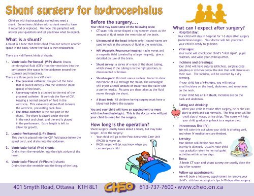 Shunt surgery for hydrocephalus - Children's Hospital of Eastern ...