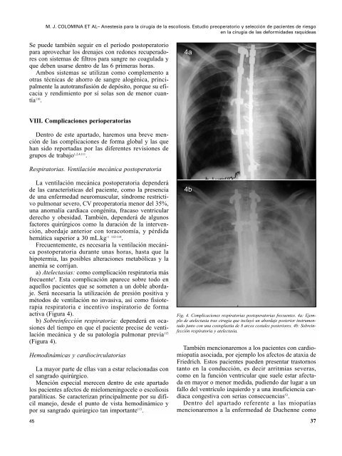 Texto completo PDF - Sociedad EspaÃ±ola de AnestesiologÃ­a ...