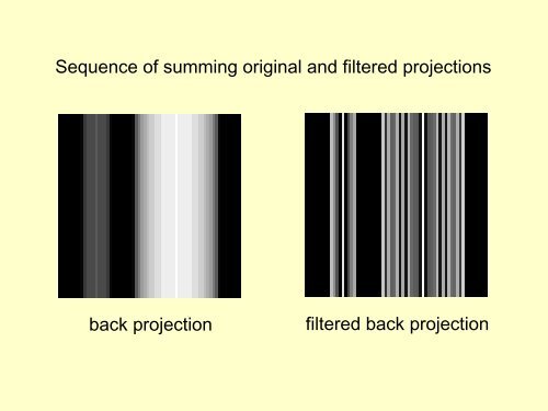 SPECT reconstruction