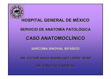 sarcoma sinovial - Hospital General de México