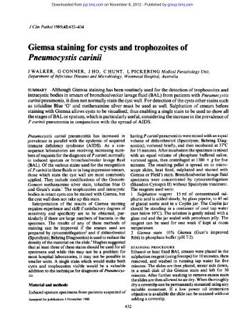 Giemsa staining for cysts and trophozoites of Pneumocystis carinii