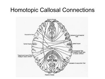 Homotopic Callosal Connections - Neurofeedback