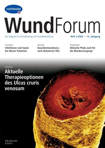 Aktuelle Therapieoptionen des Ulcus cruris venosum - Hartmann