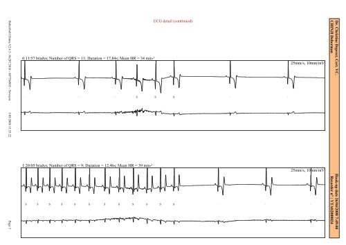 (24 H Holter) 2008 - Dobermann Review