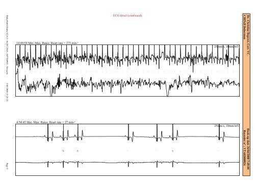 (24 H Holter) 2008 - Dobermann Review