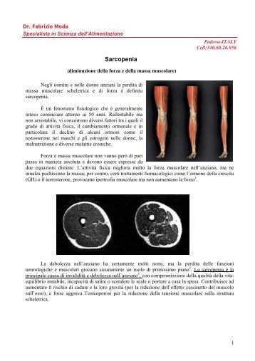 Sarcopenia - Dieta della salute - Dott. Fabrizio MODA