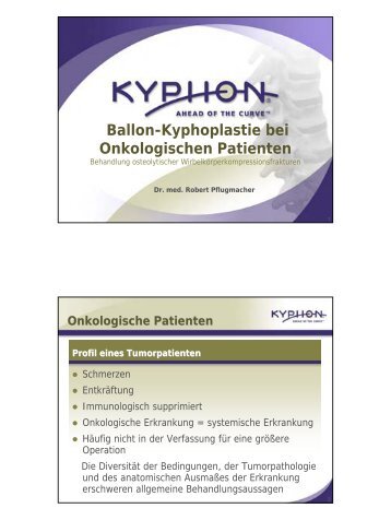 Ballon-Kyphoplastie bei Onkologischen Patienten