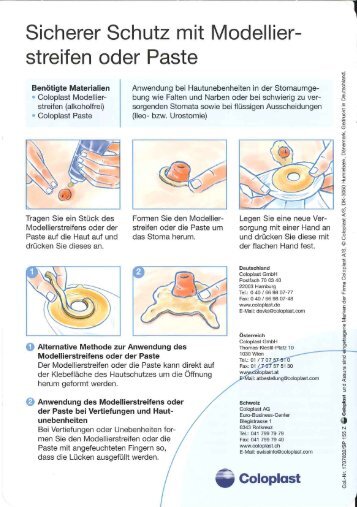 Information zur Reinigung eines Stomas - Coloplast GmbH