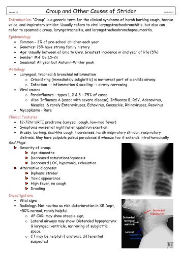 Croup and Other Causes of Stridor