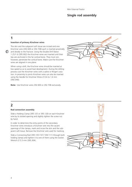 Mini External Fixator. - Osteosyntese