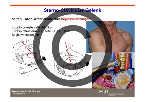 Verletzungen der oberen ExtremitÃ¤t