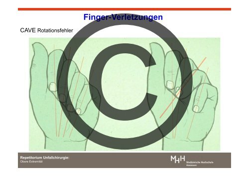 Verletzungen der oberen ExtremitÃ¤t