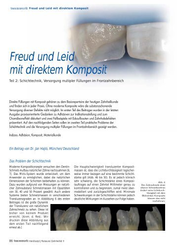 Freud und Leid mit direktem Komposit - praxis-hc.de