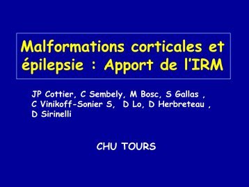 Malformations corticales et Ã©pilepsie : Apport de l'IRM