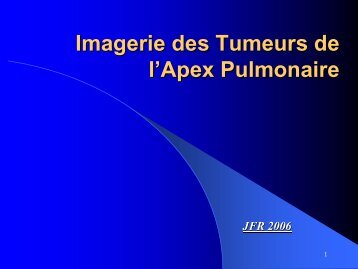 Imagerie des Tumeurs de l'Apex Pulmonaire