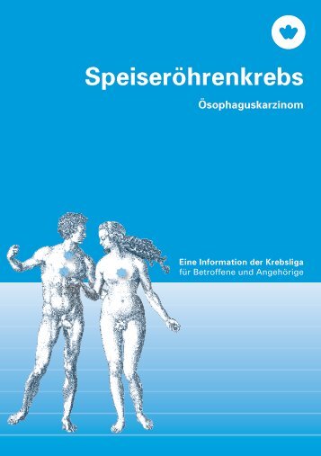 Speiseröhrenkrebs – Eine Information der ... - Krebsliga Schweiz