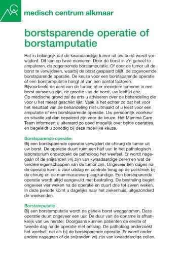 borstsparende operatie of borstamputatie - Mca