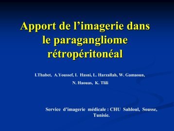 Apport de l'imagerie dans le paragangliome rÃ©tropÃ©ritonÃ©al