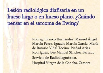 Cuándo pensar en el sarcoma de Ewing?