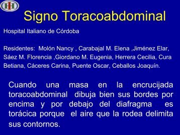 Signo Toracoabdominal - Congreso SORDIC