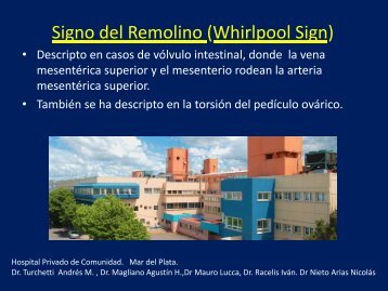 Signo del Remolino (Whirlpool Sign) g ( p g ) - Congreso SORDIC