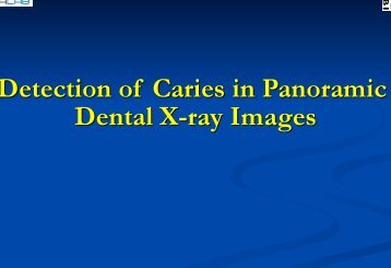 Caries Detection in Panoramic Dental X-ray Images Rev1_3.pptx