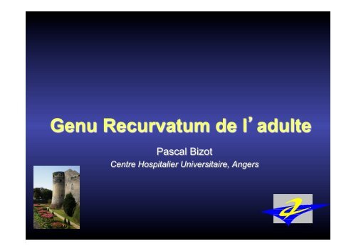 Genu Recurvatum de l - ClubOrtho.fr
