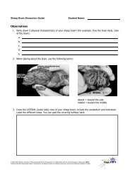 sg sheep brain dissection - BrainU