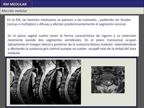 RM CRANEAL