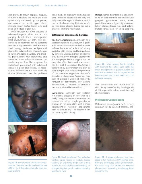 Dermatologic Manifestations of HIV in Africa - International AIDS ...