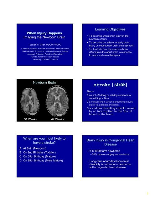 Steven Miller: When Injury Happens: Imaging the Newborn Brain ...