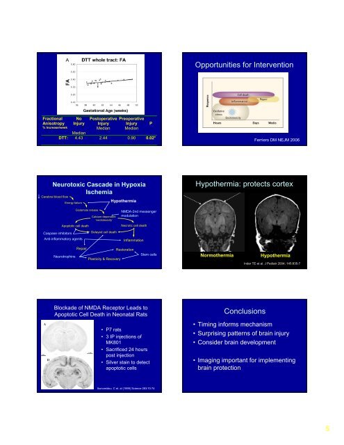 Steven Miller: When Injury Happens: Imaging the Newborn Brain ...