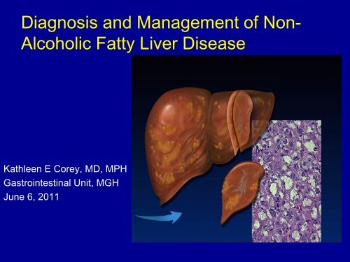 Diagnosis and Management of Non- Alcoholic Fatty Liver Disease