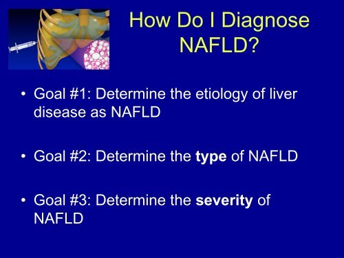 Diagnosis and Management of Non- Alcoholic Fatty Liver Disease