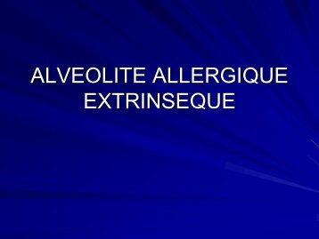 ALVEOLITE ALLERGIQUE EXTRINSEQUE