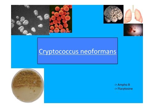 17-Cryptococcus Neoformans - PharmaEtudes