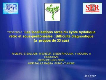 Les localisations rares du kyste hydatique rÃ©tro et sous-pÃ©ritonÃ©ales