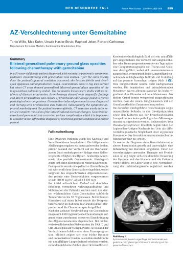 AZ-Verschlechterung unter Gemcitabine - Swiss Medical Forum