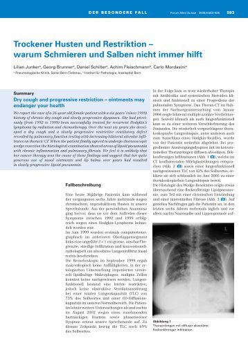 Trockener Husten und Restriktion - warum Schmieren und Salben ...