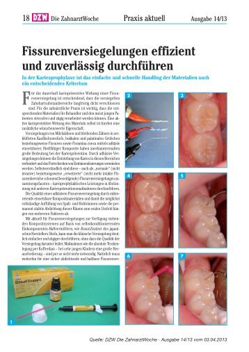 Shofu_DZW 14-13_18_DZW 00-06_01-04 - SHOFU Dental GmbH