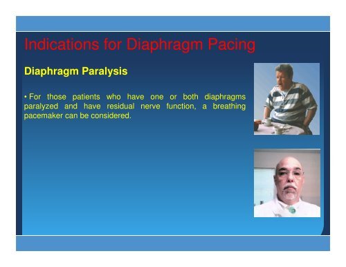 The paralyzed diaphragm - Hilary Klonin