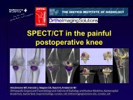 SPECT/CT in postoperative knee - British Institute of Radiology