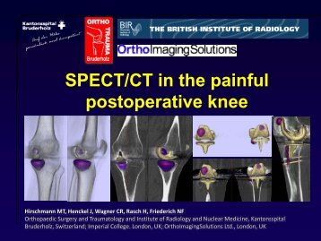 SPECT/CT in postoperative knee - British Institute of Radiology