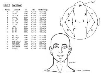 Polygrafi vid Retts syndrom