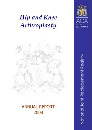 Hip and Knee Arthroplasty - Surface Hippy Guide to Hip Resurfacing