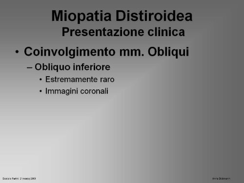 Miopatia oculare distiroidea - La Nostra Famiglia