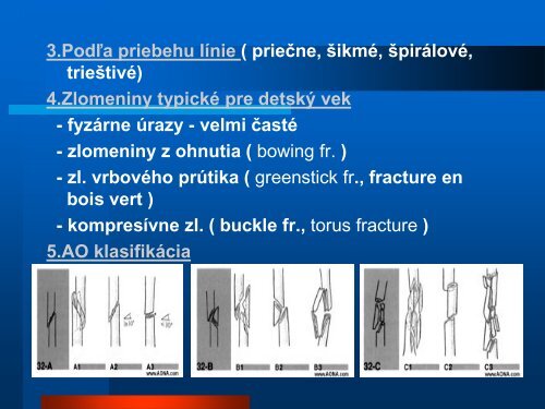 SÃºÄasnÃ© trendy lieÄby zlomenÃ­n dlhÃ½ch kostÃ­ u detÃ­.