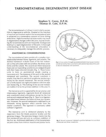 Tarsometatarsal Degenerative Joint Disease - The Podiatry Institute