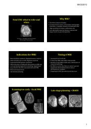 Fetal CNS: what to refer and when Why MRI? Indications for fMRI ...