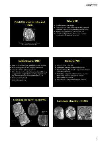 Fetal CNS: what to refer and when Why MRI? Indications for fMRI ...